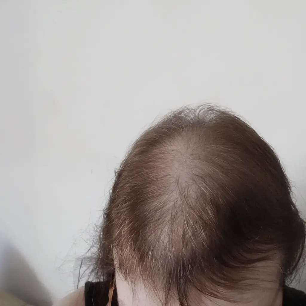 Image #1 de Mélanie